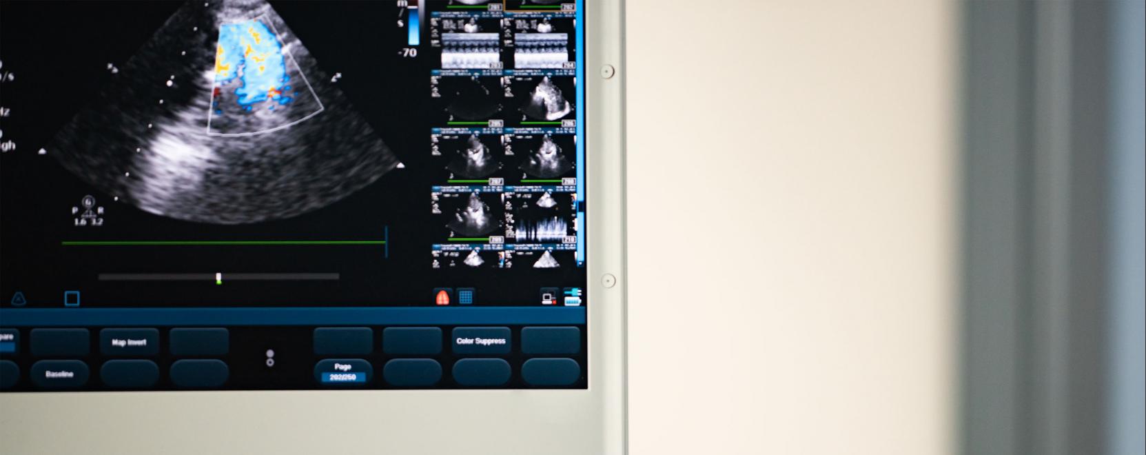 Intelligens ultrahangkészülék az orvoslásban