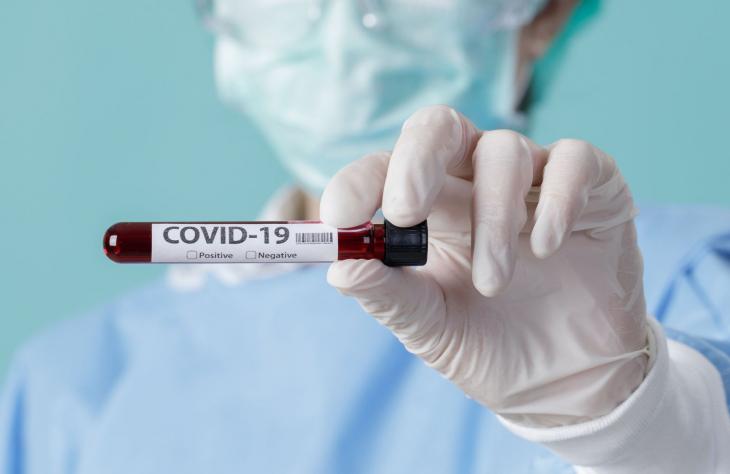 Így lehet biztonságosabb a koronavírus-teszt
